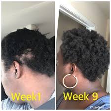 Our hair growth oil works for all hair types. Hair Growth Oil For Fast Hair Growth Hair Loss And Thinning Etsy