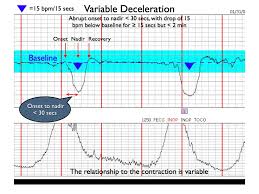 Basic Pattern Recognition Electronic Fetal Monitoring