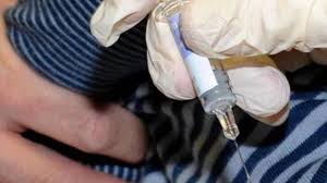 Vaccino covid in italia, dopo il lazio partiranno piemonte e friuli venezia giulia. Covid Nel Lazio Ipotesi Prenotazione Vaccino Da Medici E App Radio Colonna