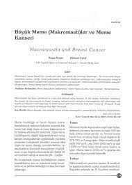 PDF) Macromastia and Breast Cancer