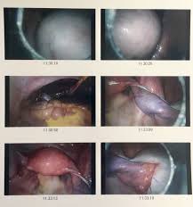 It contains structures such as hair, fluid, teeth, or skin glands that can be found on or in the skin. Why Are These Bones And Teeth Where They Shouldn T Be Medpage Today