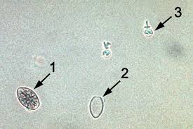 Image result for peronospora grapevine