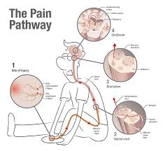 However, it can be difficult to tell sometimes if this simple injury is more complicated than you think. Neuwrite West Pain In The Brain
