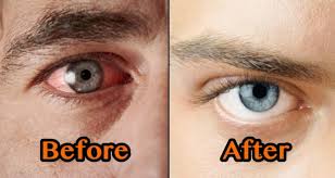 Toko kami.menyediakan obat bius chloroform obat bius chlorofil obat bius serbuk obat bius cair liquidsex obat tidur sleping biuty cara order obat bius hub: Begini Penampakan Fisik Sebelum Dan Sesudah Berhenti Merokok Kentara Banget Bedanya Lo