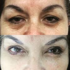 Fernanda Ayala MD (@fernni_)