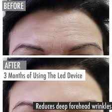 Anti Aging Led Light Therapy Device By Eternal Beauty Eternal Beauty Cosmetics