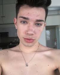 But the bumps continued to grow. Jamescharlesimagines Tumblr Blog Tumgir