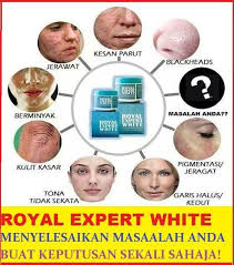 Ada setengah org akan loya. Royal Expert White Posts Facebook