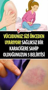 sagliksiz bir karacigere sahip oldugunuzun 5 belirtisi natural cures the cure beautiful nature wallpaper