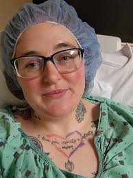 Post-operative recovery after bariatric surgery and gastric sleeve