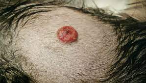 Signs and symptoms clinical signs of visceral hemangiosarcoma vary depending on the location of the tumor. Hemangiosarcoma In Dogs Everything Dog Owners Should Know