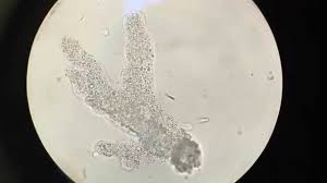 They are often described as worm like creatures, they generally are grouped into three different shapes; Hd Amoeba At 40x 100x 200x And 400x Youtube
