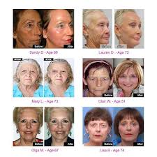 70 Year Old Grandmas Look 40 Again You Will Not Believe Their Transformations Skin Care Tips Skin Solutions Daily Skin Care