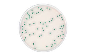 Previous scientific opinion of the biohaz panel. Al Agar Listeria According To Ottaviani And Agosti Medium Agar Food Science Bio Rad