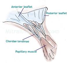 A physician was troubled to remember on which side of the heart are the mitral valves. Degenerative Mitral Valve Disease Mitral Therapies Com
