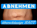 Straffe Haut nach Gewichtsabnahme - Möglichkeiten und Methoden