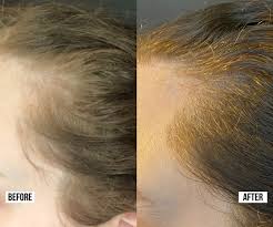 Real Stories: How Diane Saw New Growth After Ditching Toxins