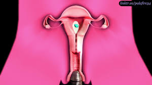 Impregnation!) Bizzare 3D Monster Using Small Sized Lara as His Fuck Toy [ PaleFire34]