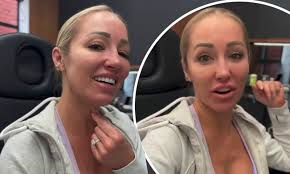 Selling Sunset's Mary Fitzgerald undergoing neck treatment after noticing  looser skin