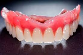 Teeth Lost To Gum Disease Can Be Replaced With A Removable Complete Denture Dental Resorts