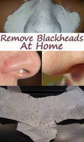 Remove Blackheads In A Natural Way My Little Beauty Corner Natural Treatments Beauty Recipe Health And Beauty Tips