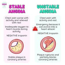 Image result for Unstable Angina