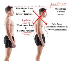 Pin On Health