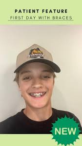 Just another day here at @okanaganortho , On most days we get to start new  braces and take some braces off. On this day these were our start and  deband patients It’s a fun contrast for us to see our ...