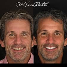 Da Vinci Dental Bellevue