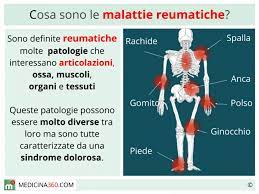 Tuttavia sono stati individuati sintomi comuni un po' a tutte queste malattie. Malattie Reumatiche Cassificazione Ed Elenco Sintomi Esami E Rimedi Naturali
