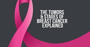 Cancer survival rates or survival statistics tell you the percentage of people who survive a certain type of cancer for a specific amount of time. The Tumors Stages Of Breast Cancer Explained