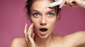 Image result for Azelaic Acid