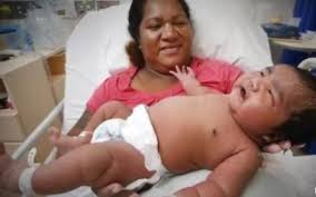 Ciertas posiciones del cuerpo hacen que el bebé tenga una forma más pequeña, lo que facilita el paso de su bebé por este. Australiana Da A Luz Bebe De 6 6 Kg Em Parto Normal Revista Crescer Parto