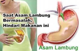 Saat Asam Lambung Bermasalah Hindari Makanan Ini Kesehatan Pengetahuan
