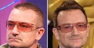 Parliamo dei nomi di hollywood e non solo: Trapianto Capelli Vip Al Pacino Trapianto Capelli Hsd