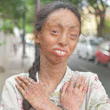 My skin won't hold me back ❤️