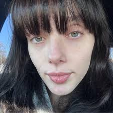 Is a 1:1:1 ratio correct for day 7?