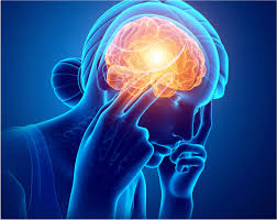 Image result for Headache Self-Help Measure