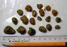 Liver And Gallbladder Flush Healthy Detox Cleanse Gallbladder Flush Liver Detox Cleanse