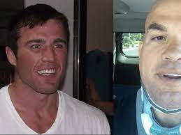 Chael Sonnen Responds To A Fresh Out Of Neck Surgery Tito Ortiz Wins The Internet Mma Imports