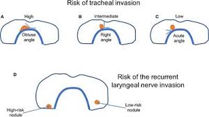 In fact, some of the possible symptoms aren't actually caused by thyroid cancer itself. Frontiers Early Diagnosis Of Low Risk Papillary Thyroid Cancer Results Rather In Overtreatment Than A Better Survival Endocrinology