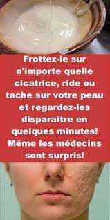 Mamzellebeauty Creme Anti Rides Fait Maison Pour Enlever Tout Typ Homemade Wrinkle Cream Homemade Anti Wrinkle Cream Life Hacks Beauty