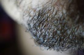 Hooman khorasani, chief of the division. The Best Ways To Prevent Ingrown Hairs After Waxing Waxing 4 Men