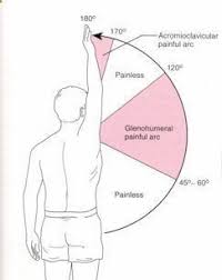 Pt Management Of Shoulder Impingement Syndrome With Research Backed Ideas Repinned B Physical Therapy Physical Therapy Assistant Shoulder Impingement Syndrome