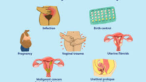 Why Bleeding Or Spotting Occurs Between Periods