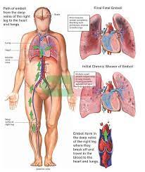 Pin On Healthy Living Plan