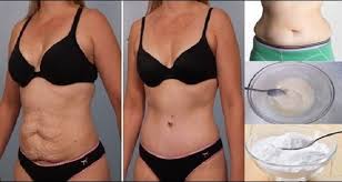 It S Easy To Gain Weight But Shedding That Extra Layer Takes Much More Than Exercise Baking Soda Present In Almost Tummy Tucks Tummy Tuck Surgery Liposuction
