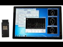 Vcds Vag Com Tweaks Codes Vw Needle Sweep Vcds Indicator Celebration Obd2 Youtube Coding Obd2 Vw Beetles