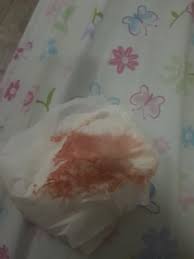 Amenaza De Aborto Club Diciembre 2019 Embarazo Y Bebes Babycenter