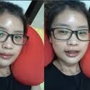 Jong-Lim Park, MD, Plastic Surgeon